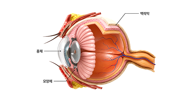 포도막염 이미지